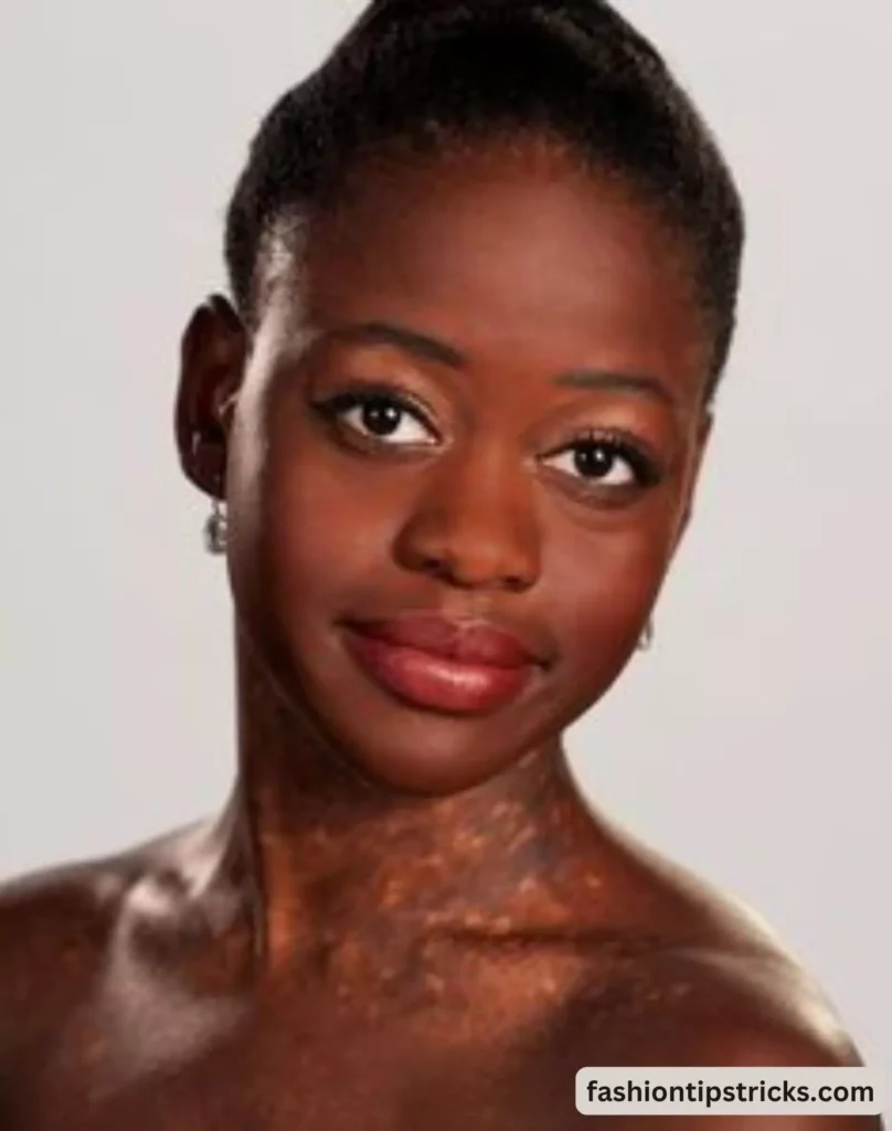 Honoring Michaela DePrince's Remarkable Journey